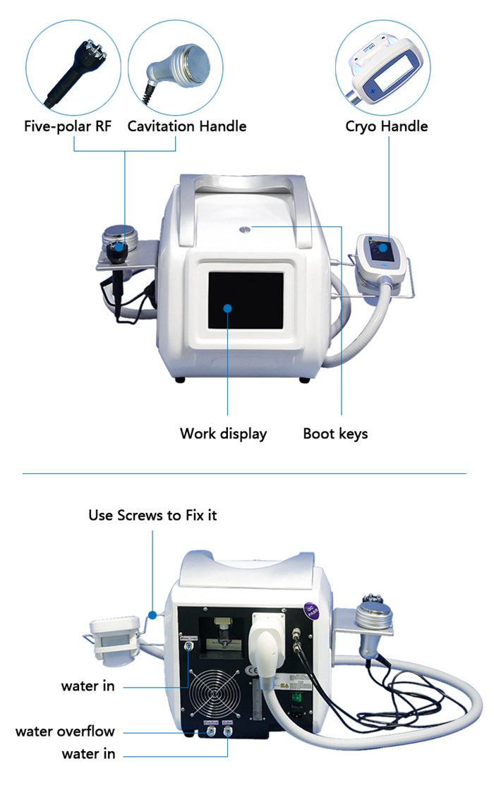RF cavitation cryo handle RF cavitation cryo handle